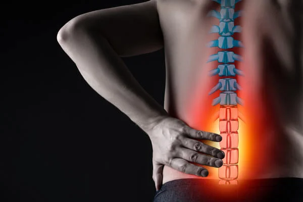 Sciatica Nerve Pain Kidderminster